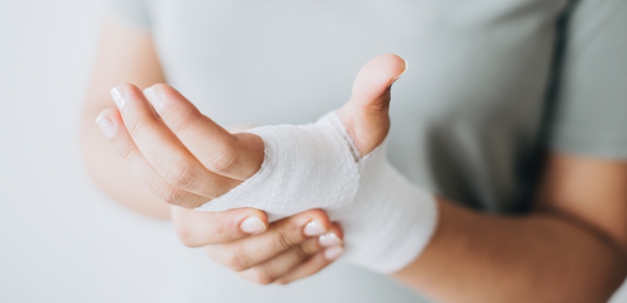 Queimaduras: atividades do dia a dia são as que causam mais vítimas